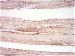 MuRF1/TRIM63 Antibody (7B8E1) - BSA Free, Novus Biologicals 0.1mg; Unlabeled:Antibodies,